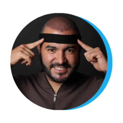 transplant hair turkey