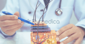 Haartransplantation Wachstum nach einer Haartransplantation – Was passiert nach 3 Monaten